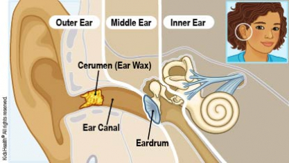 Tvidler Ear Wax